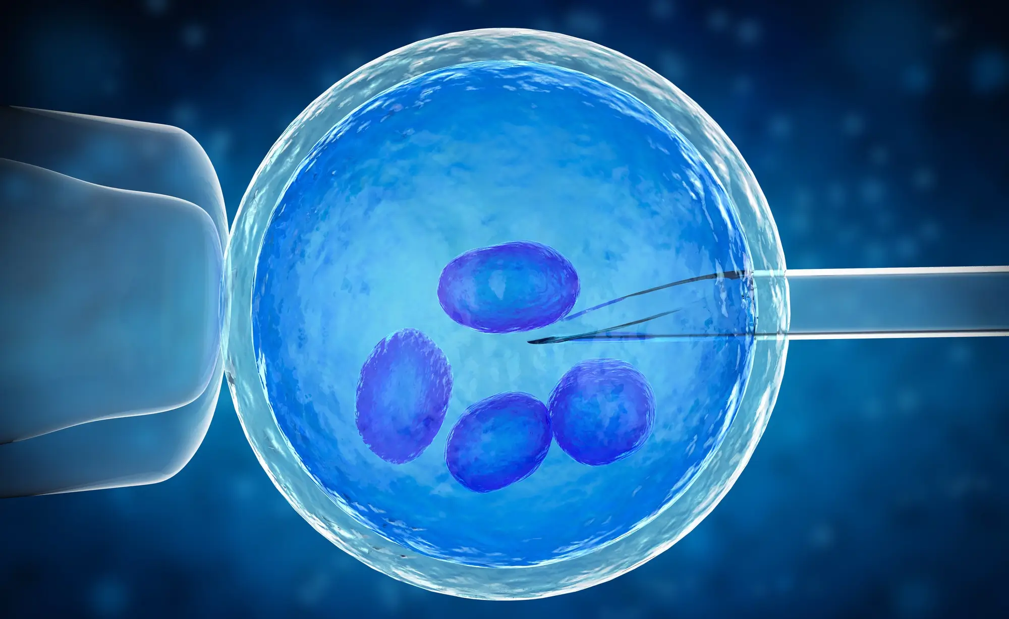 IVF Treatment in Chennai